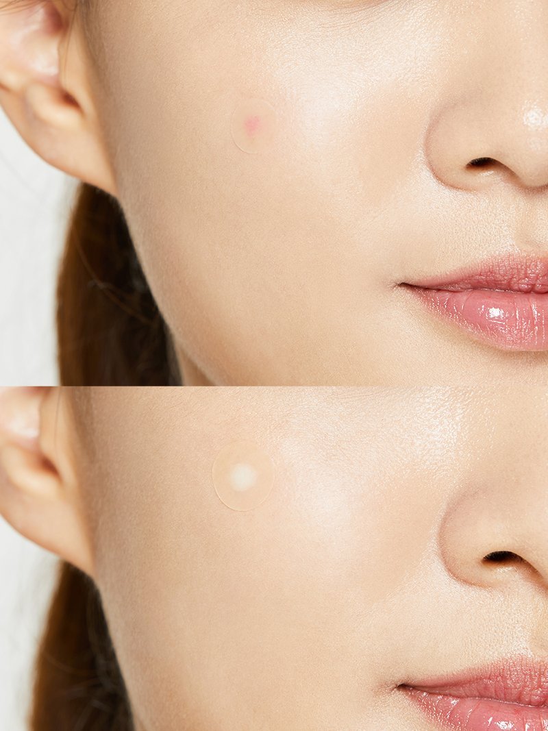 Pimple Patches - Imagen 4